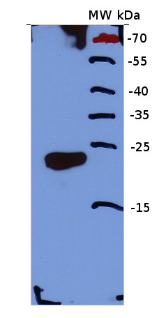 western blot using anti/calcineurin hand motiff antibody